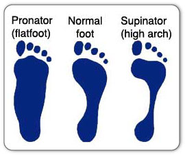 Plantar fasciitis can be caused by improper foot mechanics such as pronation (flat feet) and supination (high arches).